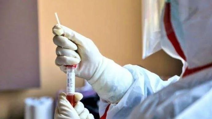 Rekord i zi në Maqedoni të Veriut: 870 të infektuar dhe 14 viktima gjatë 24 orëve