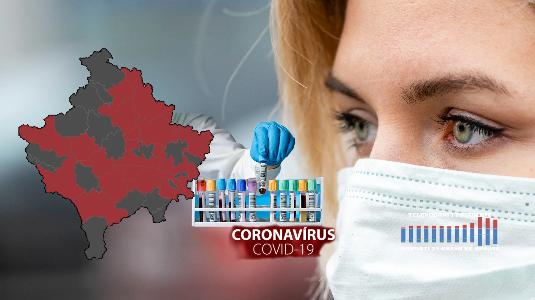294 raste të reja me koronavirus, 7 raste në Prizren