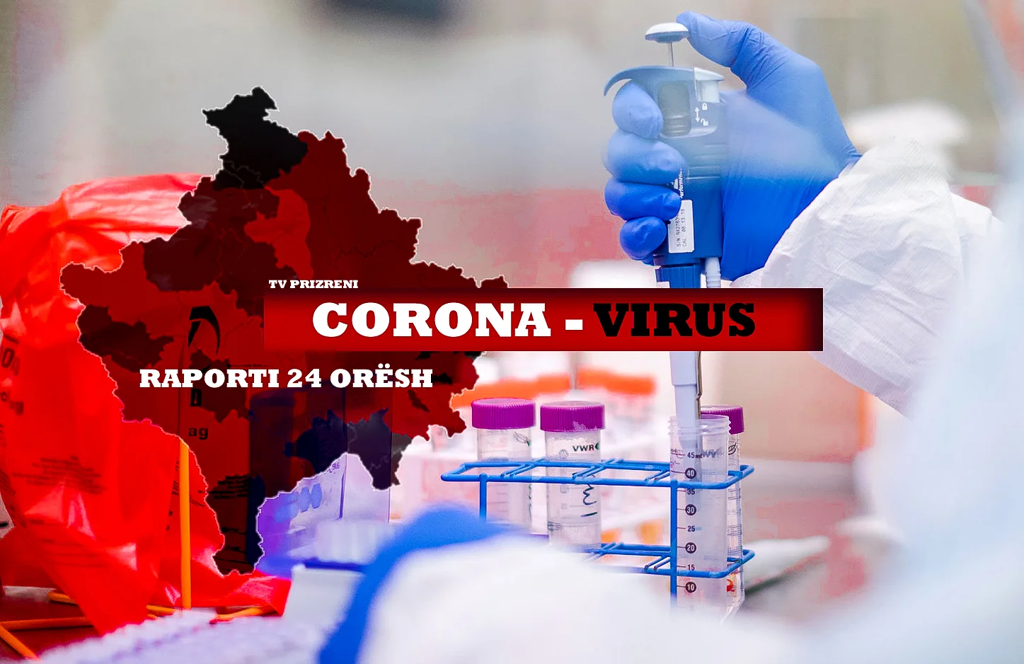 318 raste me COVID-19 në Kosovë, 38 në Prizren