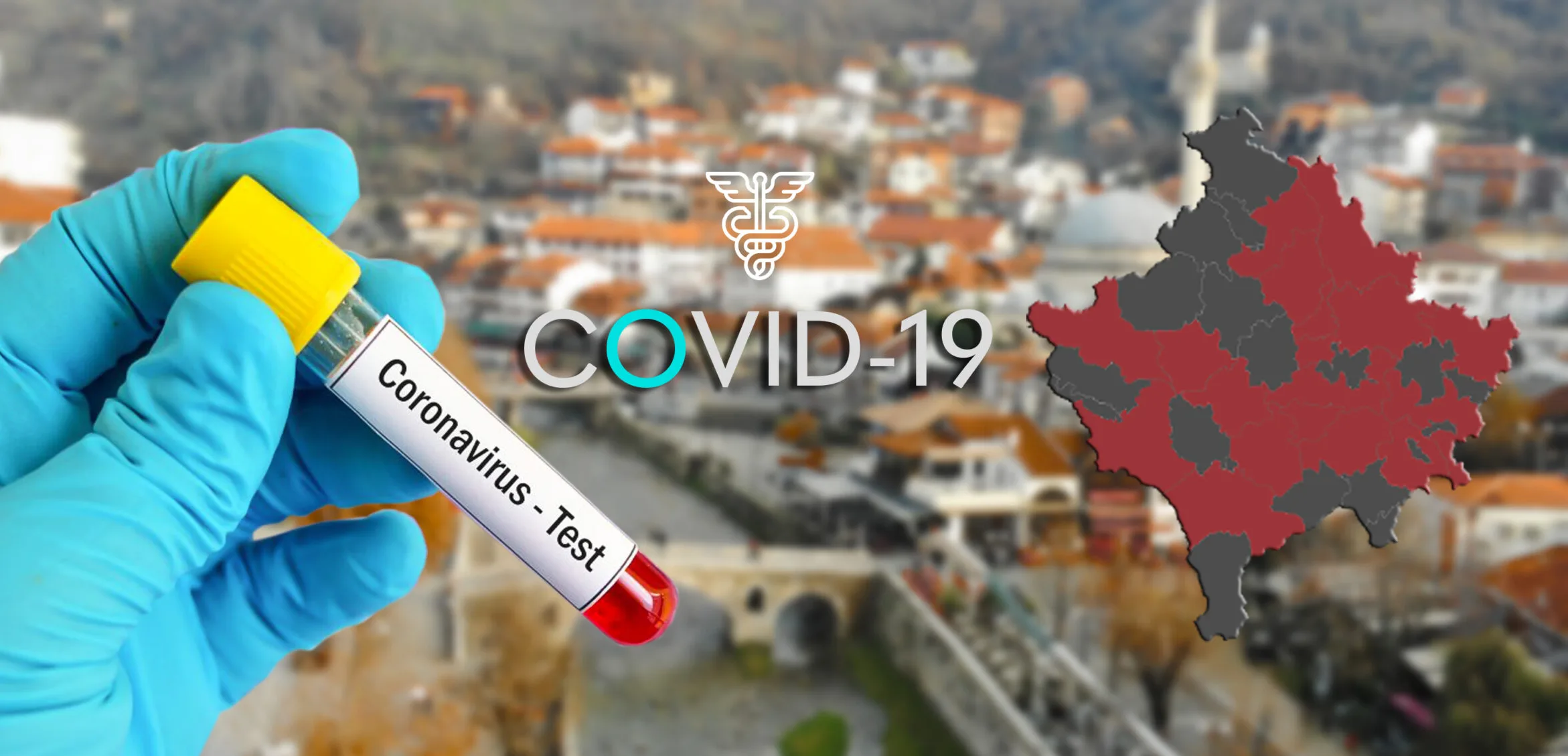 297 raste të reja me Covid-19 në Kosovë, 20 në Prizren