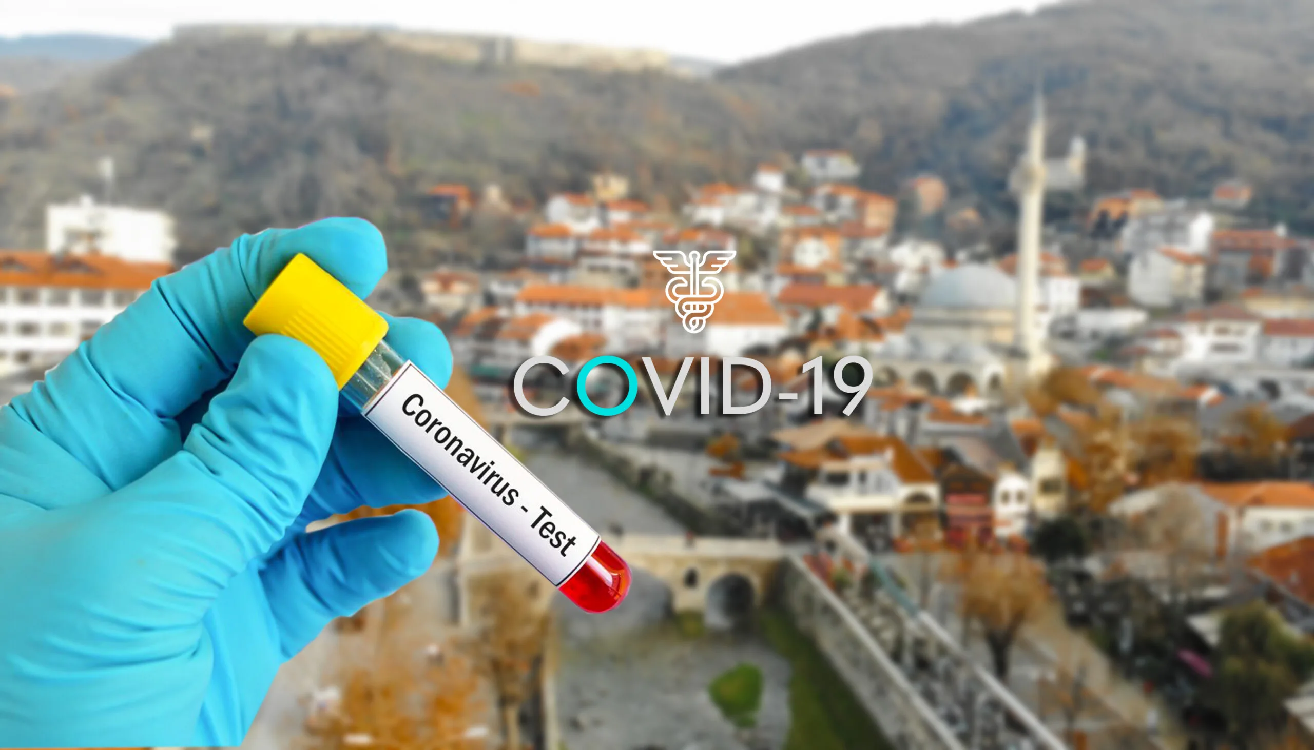 461 raste me Covid-19 në Kosovë, 24 në Prizren