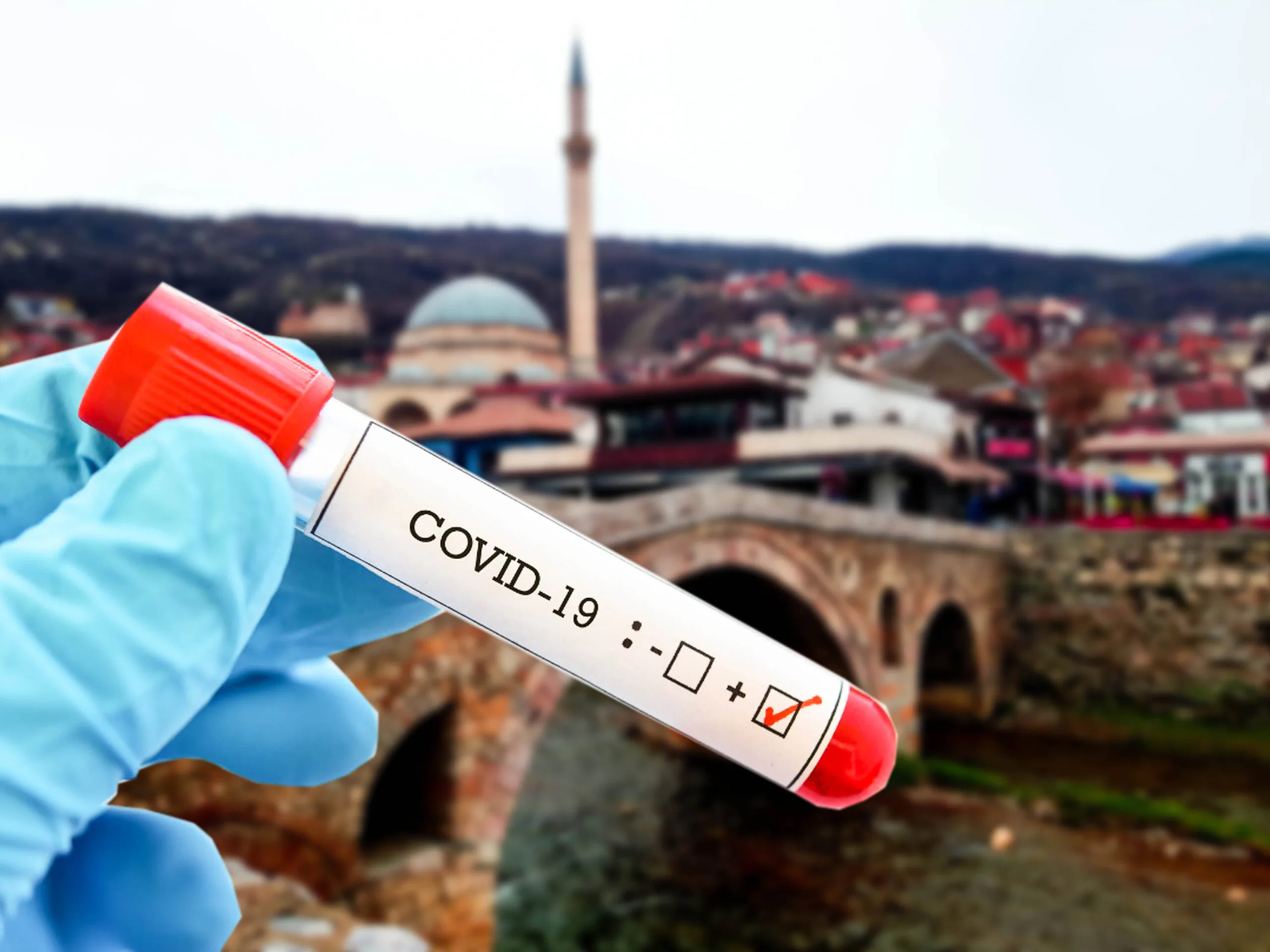 Një i vdekur e 12 raste të reja me koronavirus në Kosovë