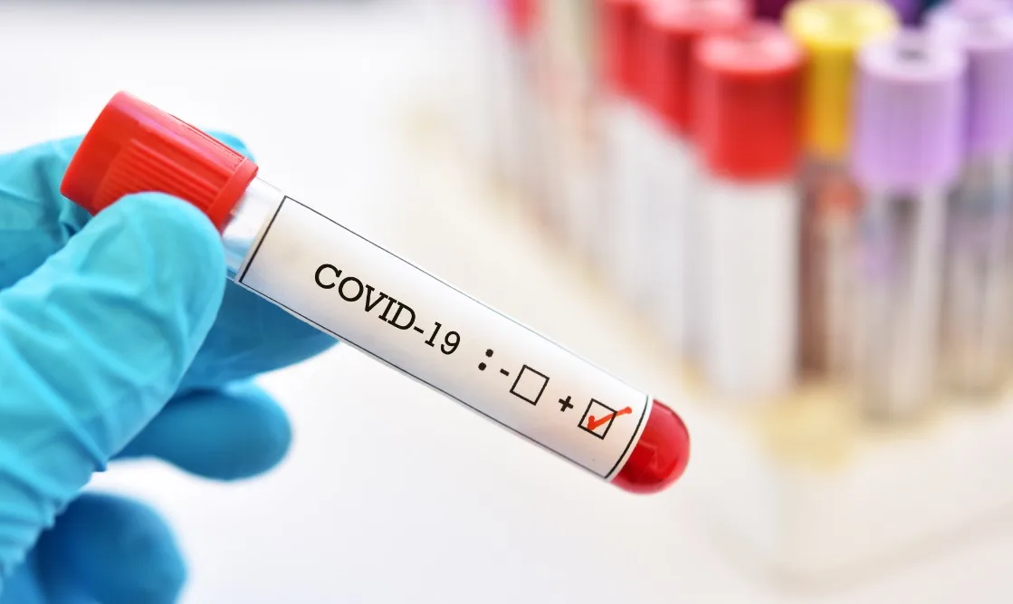 16 të vdekur dhe 2,098 të infektuar me coronavirus në 24 orët e fundit