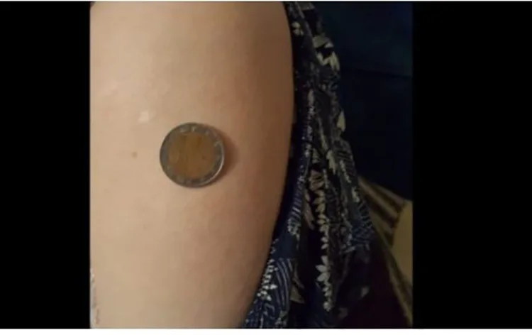 Kosovari u ankua se vaksina Anti Covid i shkaktoi magnet, i përgjigjen fizikantët