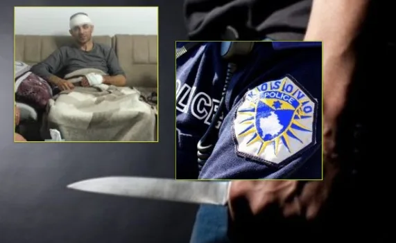 Ky është polici që u plagos me thikë në kokë gjatë ditës së djeshme në Suharekë