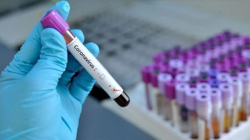 740 raste aktive me koronavirus në Kosovë