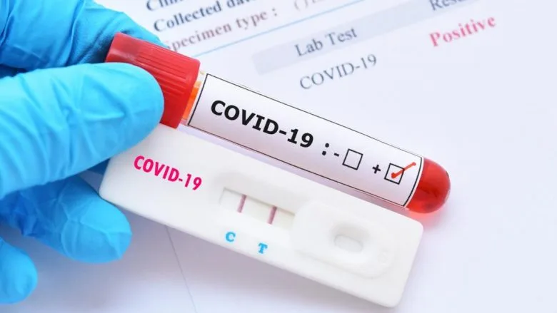 363 raste të reja me coronavirus në Kosovë
