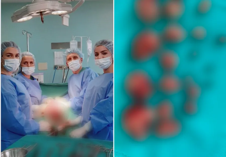 Kryhet një operacion i rrallë në Gjinekologjinë e QKUK-së