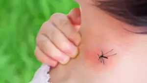 “Kujdes nga pickimet e mushkonjave”, IKSHPK me këshilla për mbrojtje nga malaria