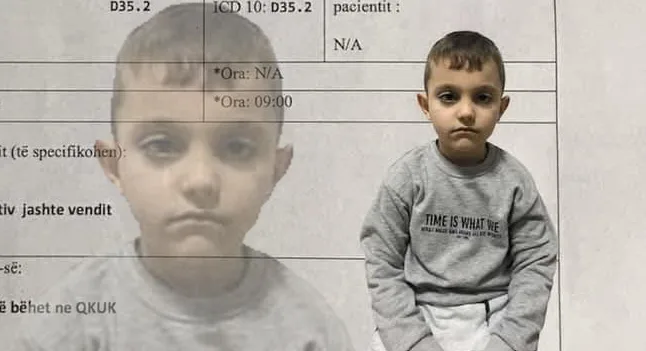 Kërkohet ndihmë për Rigon Berishën, 6-vjeçarin nga fshati Buçe të Dragashit